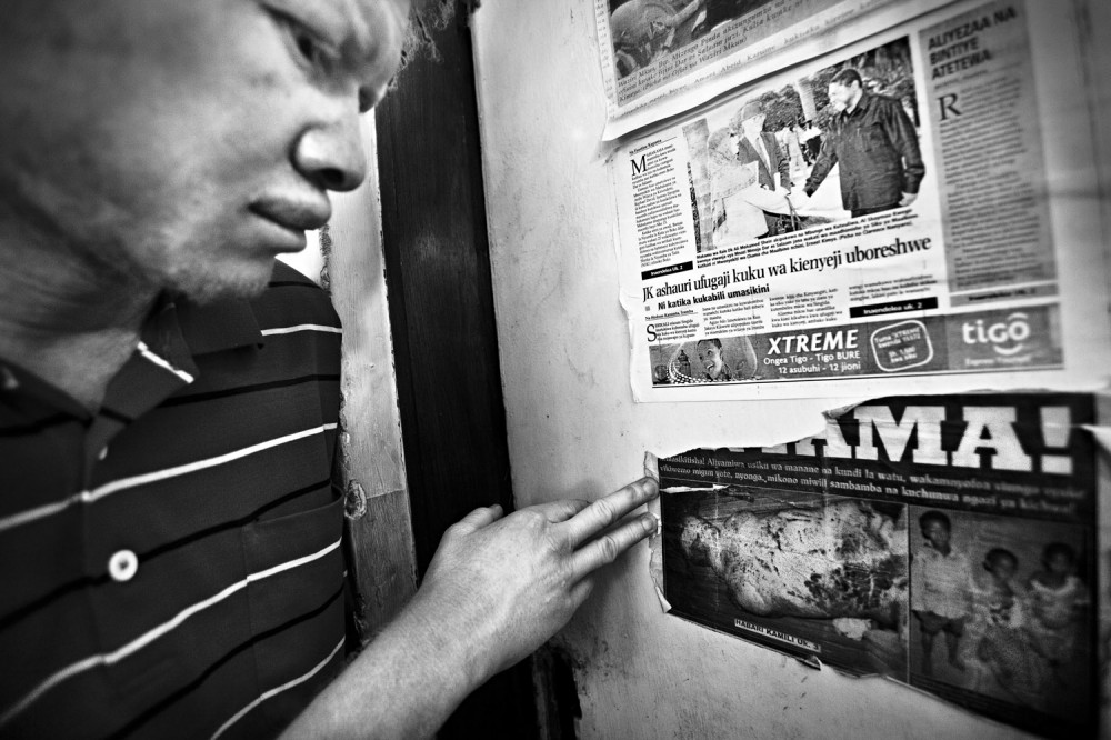 FVO-Albino-Killing-Tanzania-1.jpg