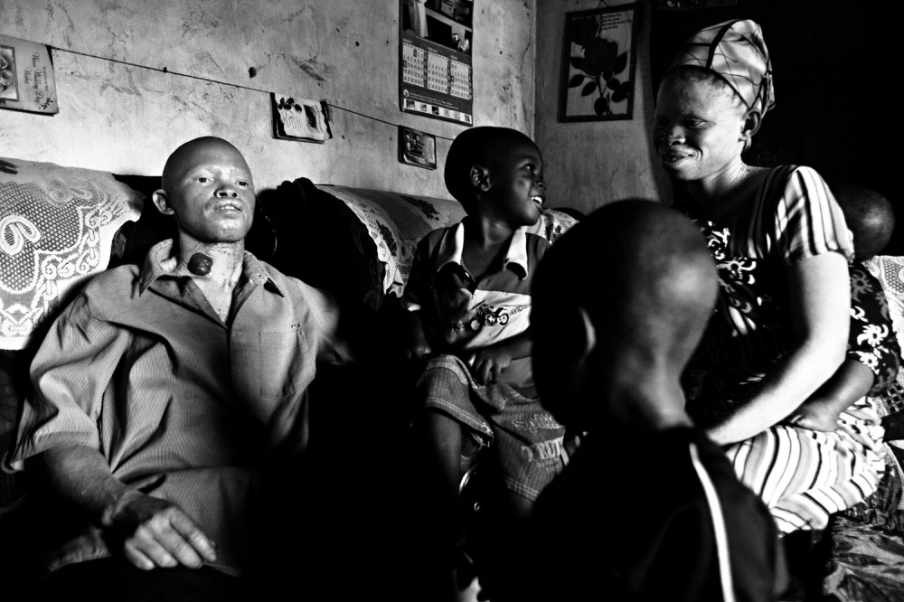 FVO-Albino-Killing-Tanzania-12.jpg