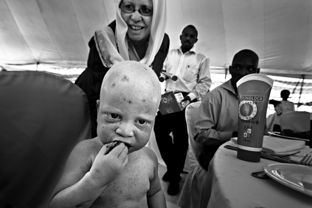 FVO-Albino-Killing-Tanzania-15.jpg