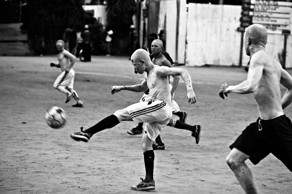 FVO-Albino-Killing-Tanzania-26.jpg